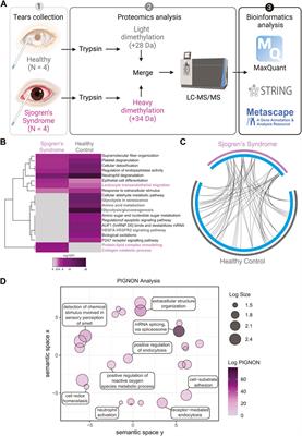 Proteomics Analysis of Tears and Saliva From Sjogren’s Syndrome Patients